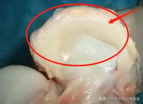 周琦受伤后的状态,体育运动最容易受伤的十个部位