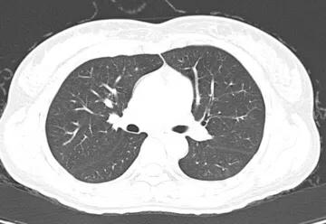 讲解医学影像的书,医学影像学几年