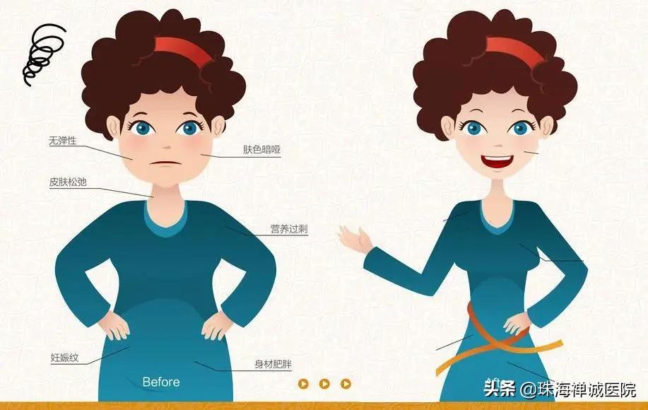 是否要做产后治疗,要不要做产后修复