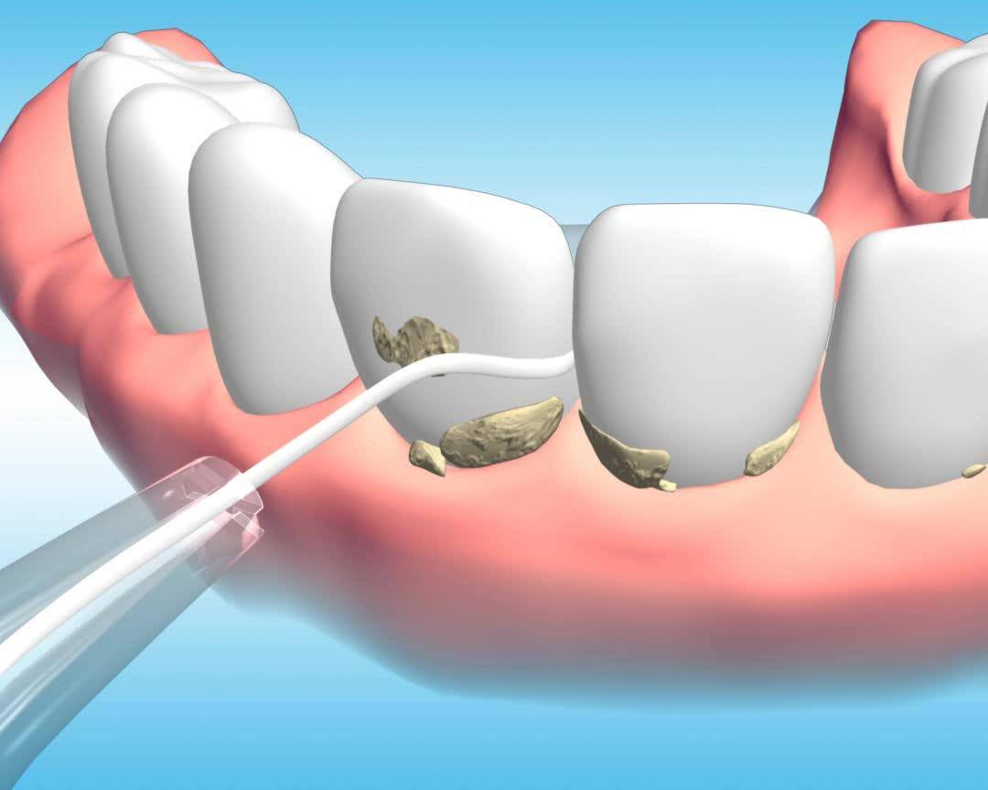 春季唇妆,唇妆不好看