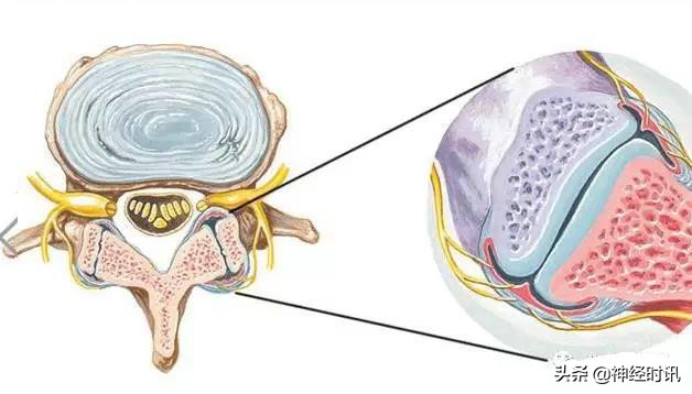 病理脚麻的最快恢复方法,脚麻诊断思路
