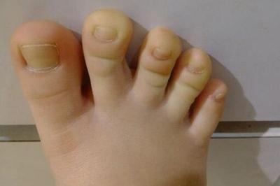 俗话说二脚趾头长不养娘是真的吗,俗话说二脚趾头长不养爹和娘