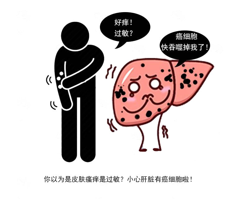 肝不好会引起皮肤痒吗,肝区皮肤痒怎么回事