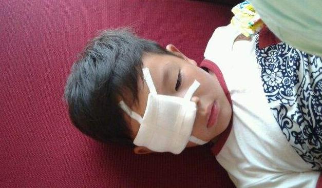 小孩石灰进眼睛,宝宝石灰进入眼睛处理方法最正确