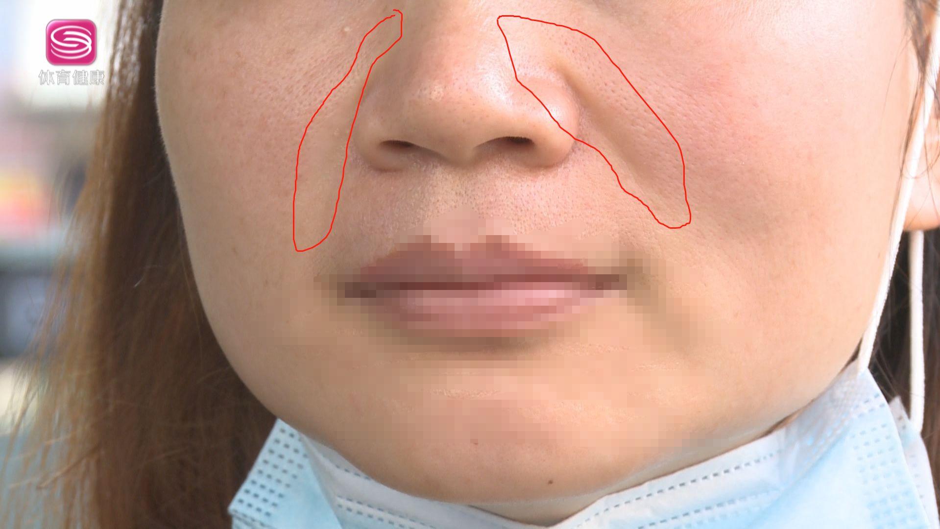 3分钟淡化法令纹你一定能学会,法令纹重非医美手段怎么改善