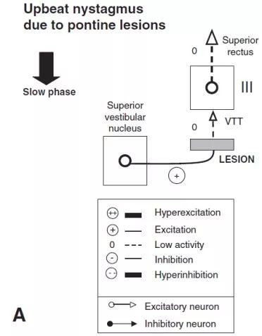 上跳性眼震能自愈吗,位置性眼震及眩晕