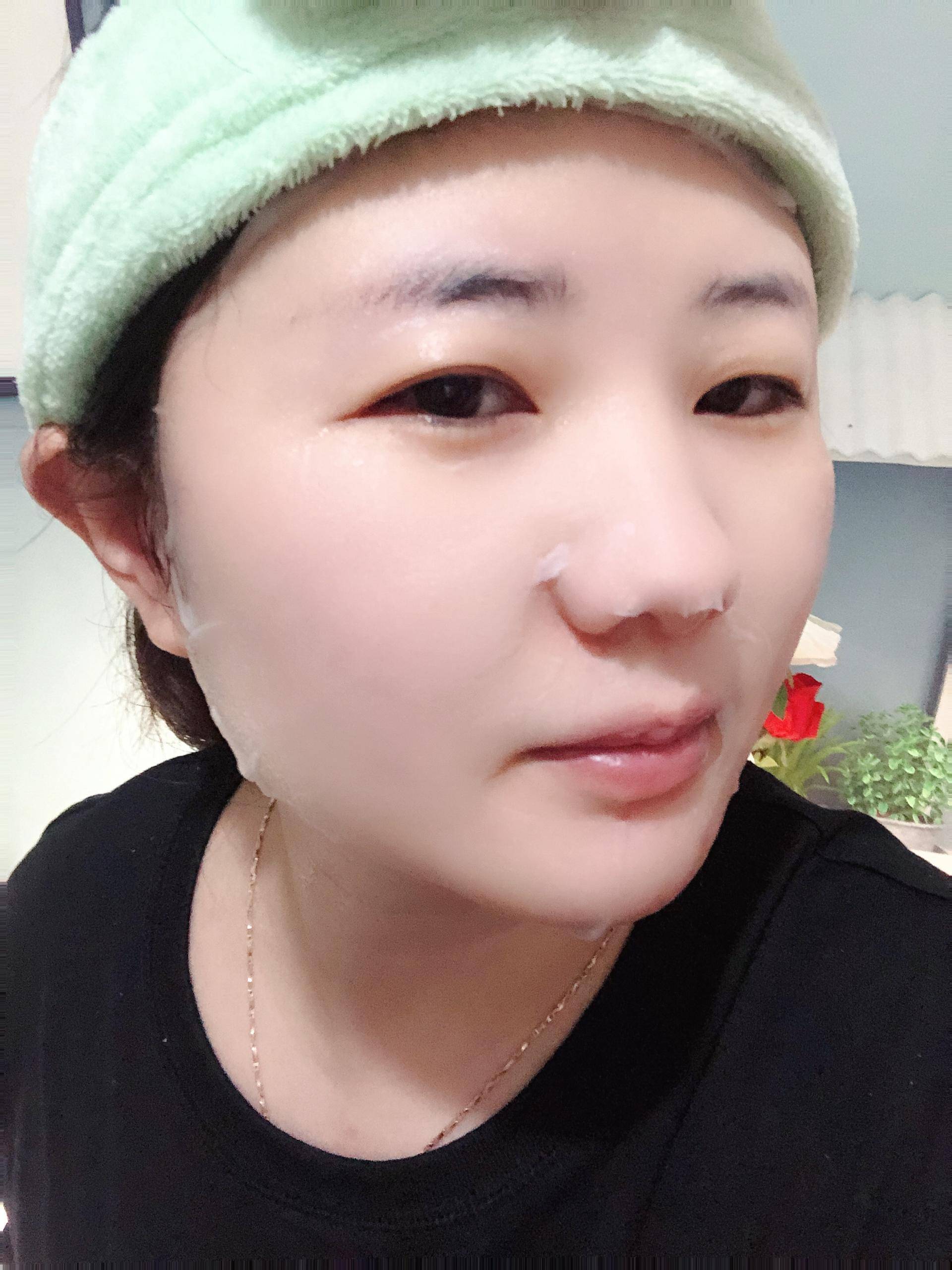 医用冷敷贴脸推荐,医用冷敷贴有补水的效果吗