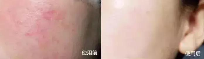 韩国小灯泡美白精华怎么样,韩国小灯泡精华真的能变白吗