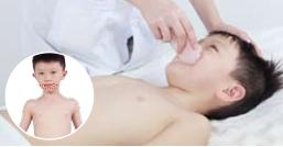 中医治流口水的推拿,小儿流口水灸什么穴位