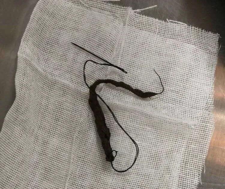 “我居然从猫屁股拽出了一根针！太可怕了！”