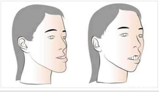 你经历过的疼痛,牙齿疼起来是一种什么感受