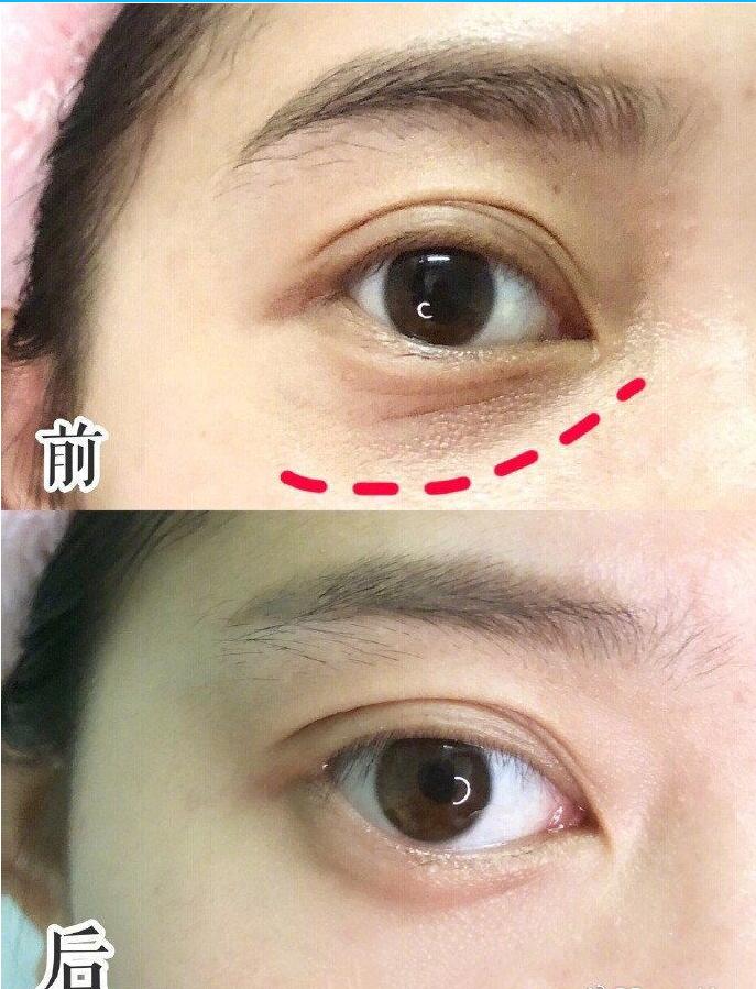 六胜肽眼霜抗皱去细纹淡化黑眼圈,六胜肽眼霜好吗