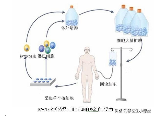 什么是免疫治癌,什么是癌症免疫治疗和生物治疗