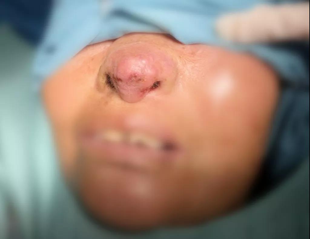 西安医学院一附院,西安医学院一附院整形美容科