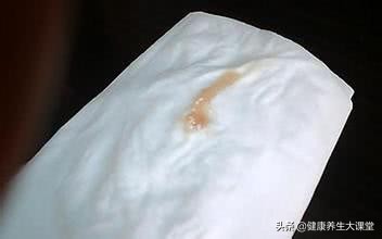 内裤上面很黄是妇科炎症吗,内裤上不脏也会有严重妇科病吗