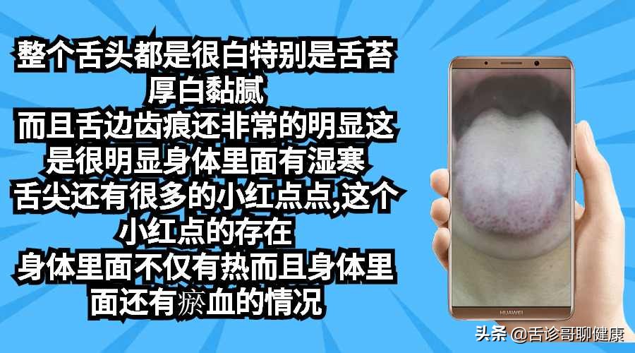 肺结核头晕头痛胸口闷是正常吗,肺结核治疗期头晕是什么原因