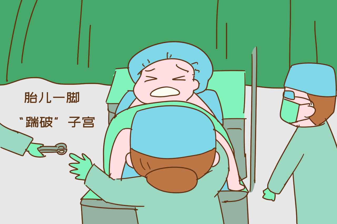 剖宫产两个月被小孩踹到肚子还疼,剖腹产被宝宝踢了一脚