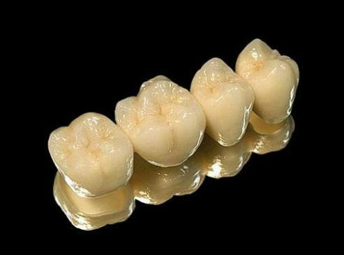 现在最便宜的假牙多少钱一颗,目前国内最好的假牙是多少钱