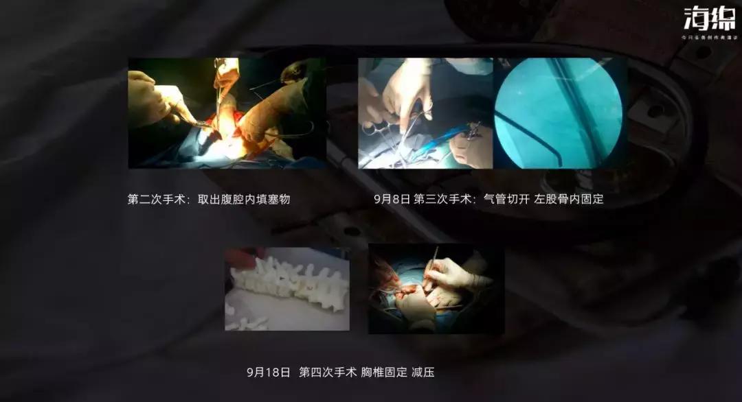 真的有icu吗,到底能相信icu吗