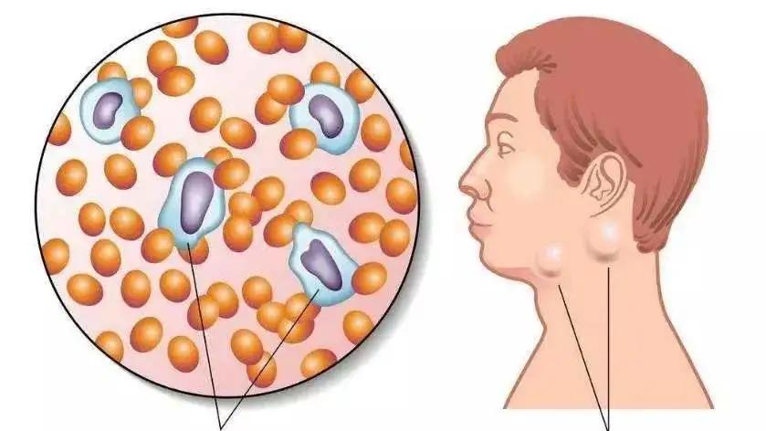 颈部里面长了个硬疙瘩,颈部长硬疙瘩挂什么科