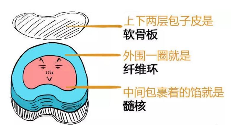 腰间盘突出别发愁记住3个技巧,专家告诉你腰间盘突出该怎么解决
