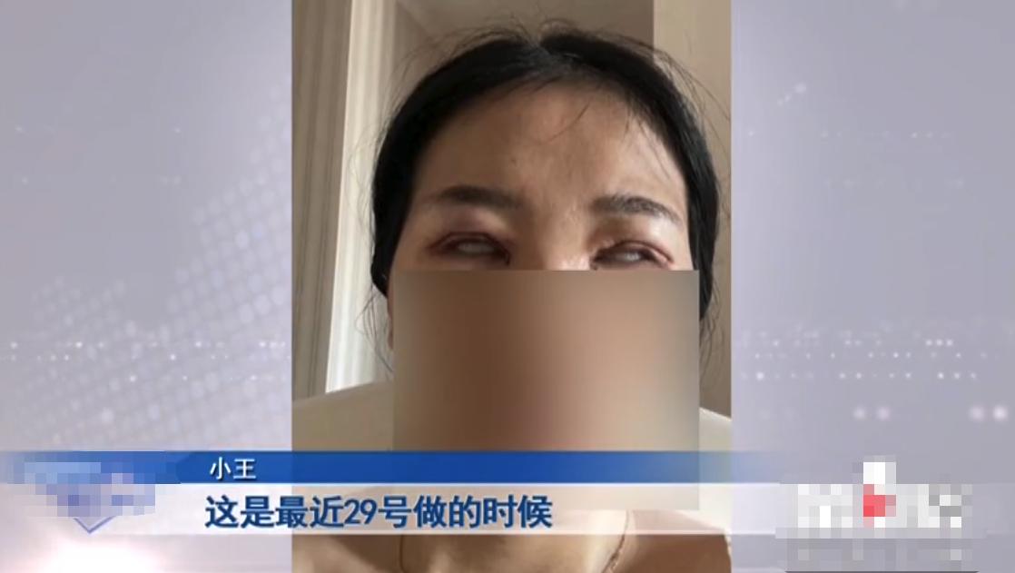 “老公骂我是怪物，要跟我离婚！”重庆女子三次割双眼皮却越割越丑，整容变“毁容”？女子：想死的心都有了