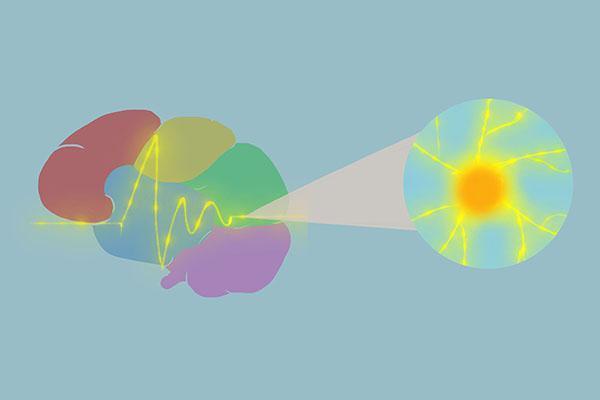 肌肉萎缩是由什么原因引起的,老人肌肉萎缩是什么原因引起的