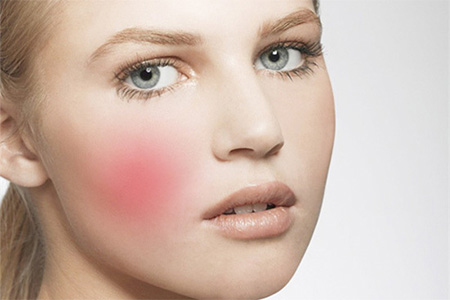 面部红血丝角质层太薄,角质层太薄怎么做深层清洁