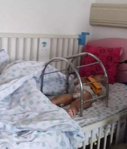 孩子玩滑滑梯屁股被烫伤,孩子玩滑梯摔了屁股