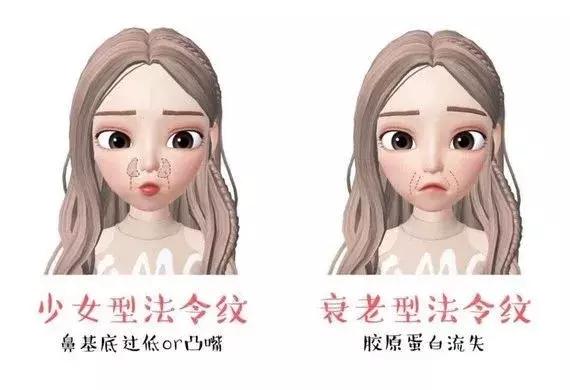 怎样改善法令纹深脸部下垂,怎样改善法令纹木偶纹