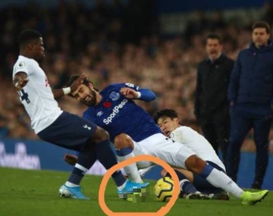 戈麦斯断腿事件结果,英超戈麦斯