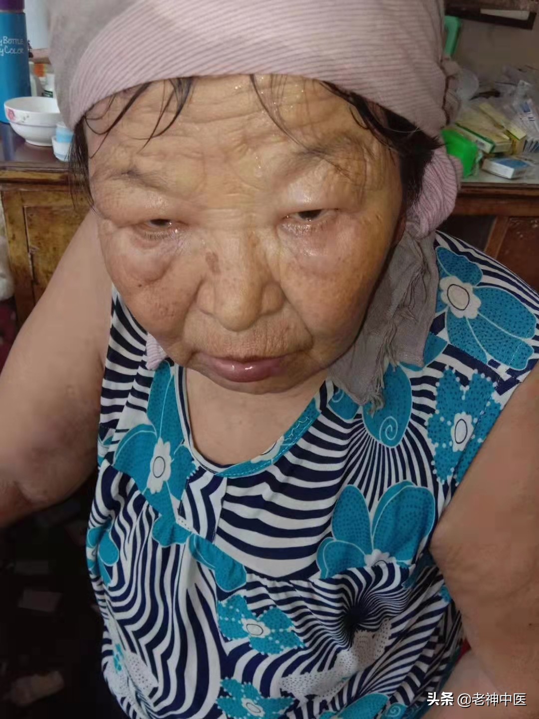 汗多一动就大汗淋漓中医辨证,体虚自汗的原因和治疗方法