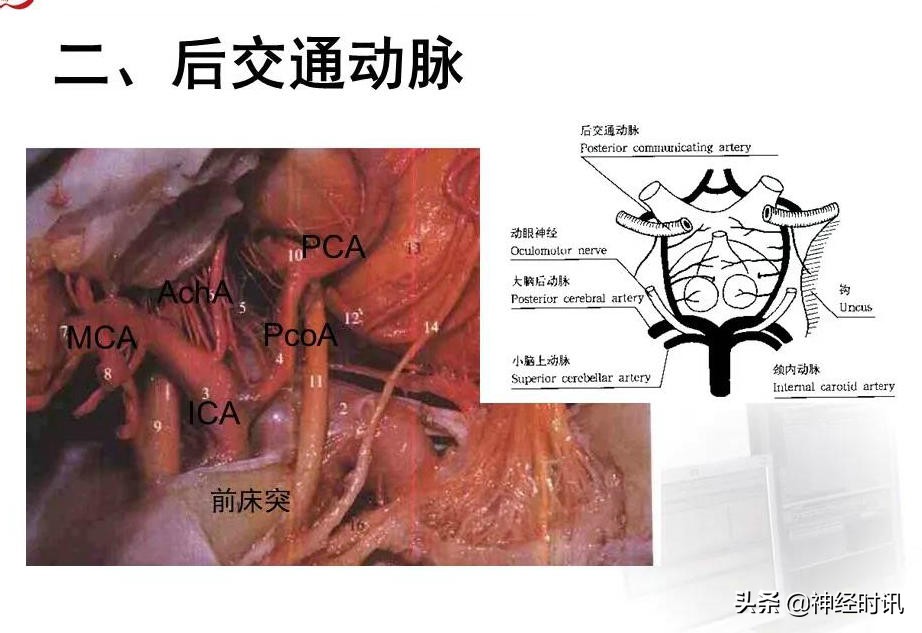 脑动脉解剖学讲解,基底节区脑血管解剖