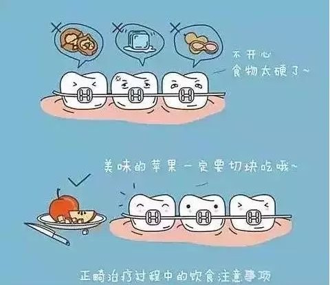 改“斜”归正让你的牙齿整齐起来