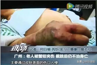 一只螃蟹把一个人吃得只剩下半身,一只螃蟹把另一只螃蟹给吃了