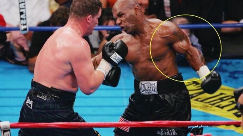 泰森精彩表现视频,泰森绝地反击视频