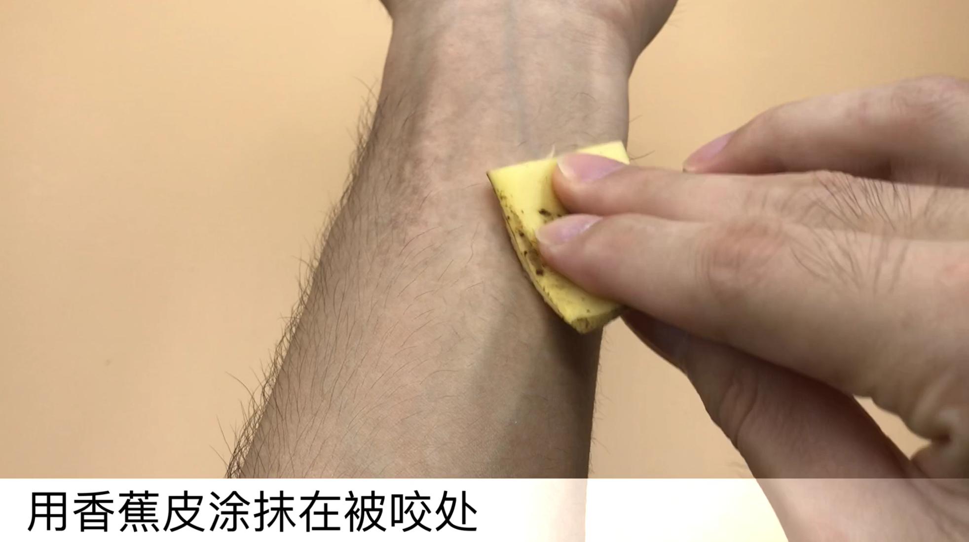 香蕉皮太厉害了，好多人的难题全都解决了，看完赶紧告诉家里人