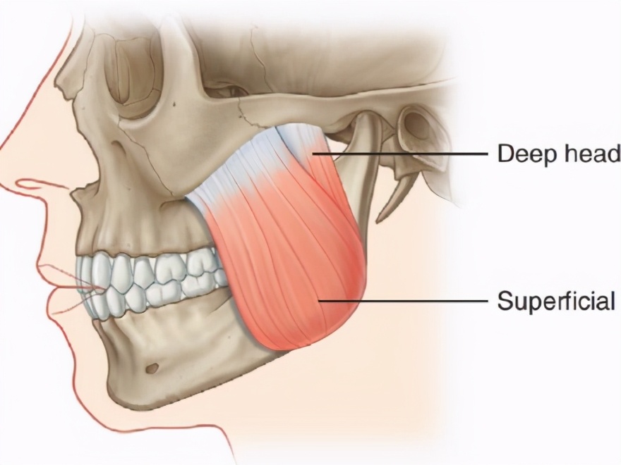咬肌型发腮怎么改善,大脸方脸女生如何快速改变脸型