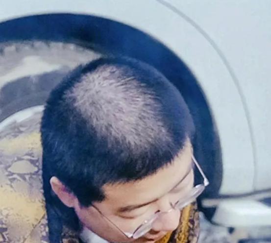 怎么护理头发干枯毛躁掉发,如何护理干枯分叉的头发