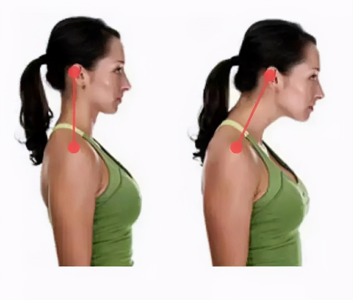 纠正乌龟颈最有效的方法,改善乌龟颈动作丁香医生