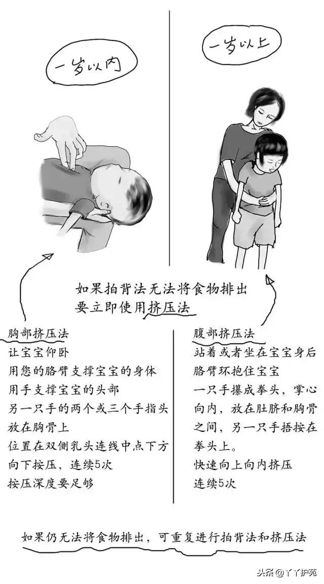 大人气管异物急救法操作过程,婴幼儿气管异物堵塞的急救处理