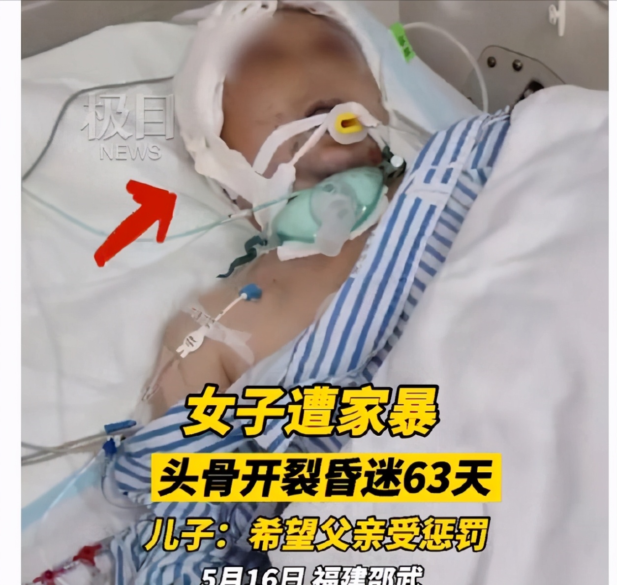 52岁女子遭丈夫家暴,29岁女子被家暴16次事件