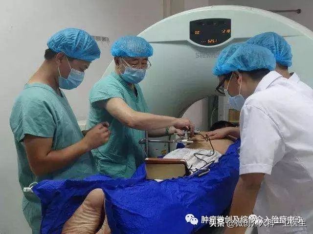 四川肿瘤医院碘125粒子植入术,肿瘤碘125粒子植入术图片