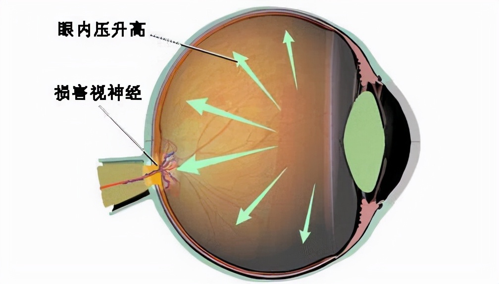 人的眼球脆弱吗,人的眼球变黄怎么办