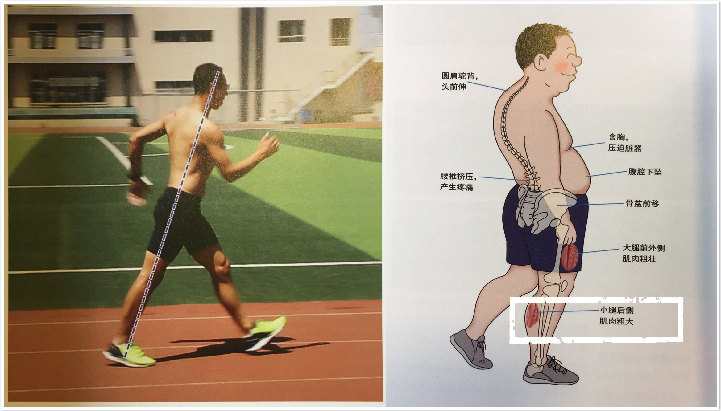 小腿粗如何拉伸变细腿,别相信运动能减肥