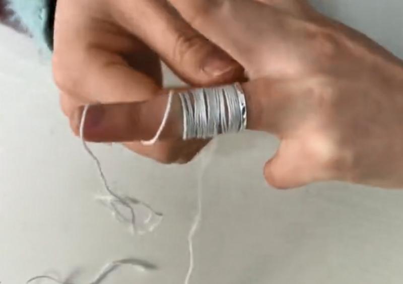 戒指取不下来别着急一招轻松解决,戒指戴手上肿胀取不下来怎么办