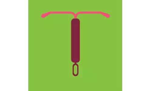 避孕有哪些方法不上环,经期避孕和安全套避孕