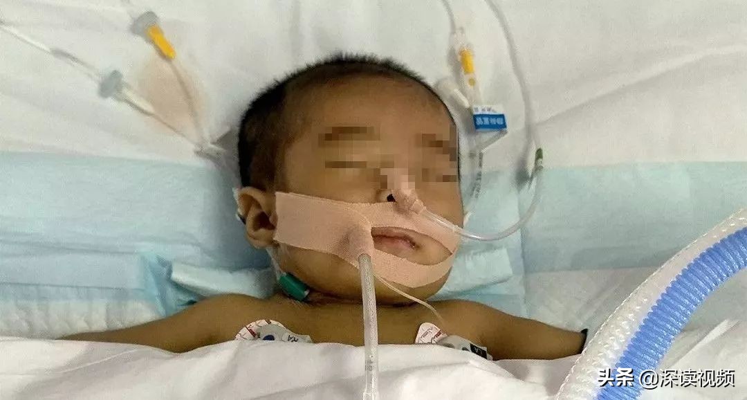 肝硬化70,肝硬化7.75严重吗