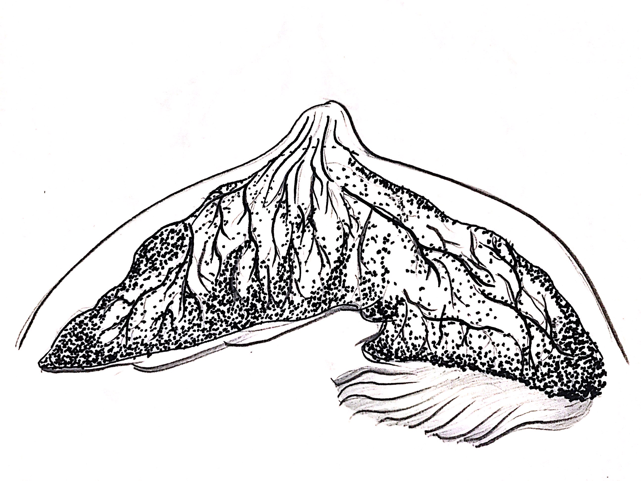 得了乳腺癌为什么不让来月经,得了乳腺癌为什么不愿切乳房