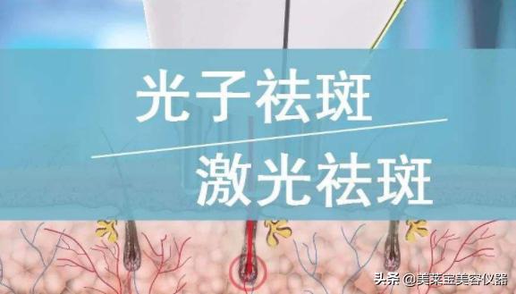 美容仪器祛斑仪器有用吗,美容激光和光子嫩肤区别